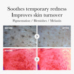 Red Succinic Acid Panthenol Pads