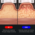 AGE-R Contour Body Shot